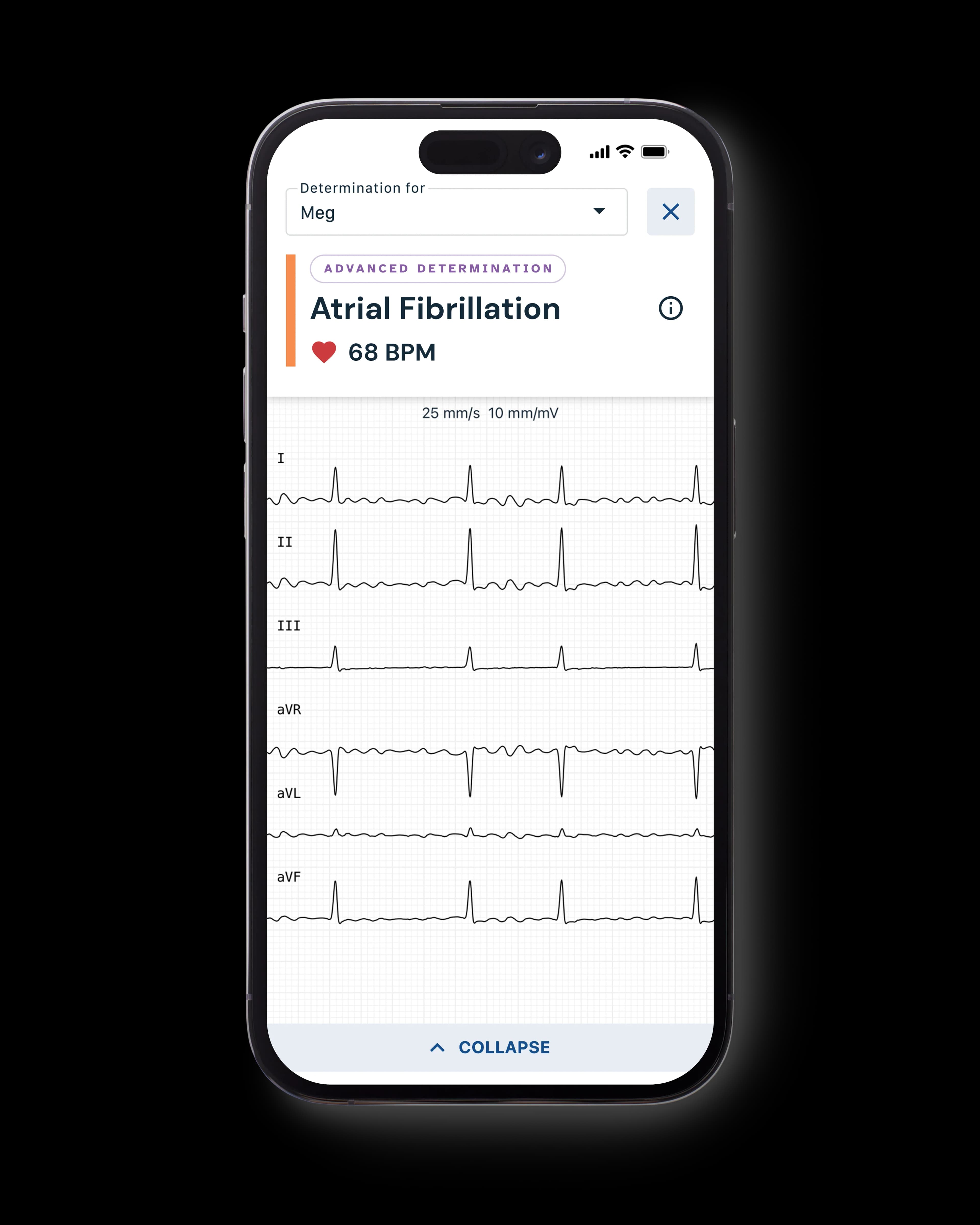 View your instant results