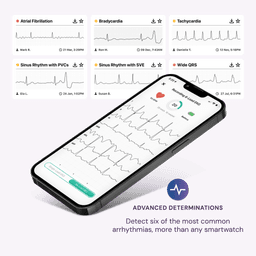 KardiaMobile® Card